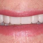 Gilmore Dental Cosmetic Dentist in Redmond