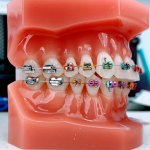 Golub Orthodontics Cosmetic Dentist in Fort Lee