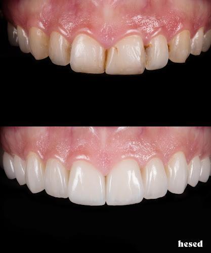 Negocio Hesed Dental | Cosmetic Dentistry Nj