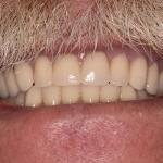 Huntline Dental Group Cosmetic Dentist in Westphalia