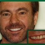 Jefferson City Dental Care Cosmetic Dentist in Jefferson City