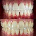 Kagy Family Dental Cosmetic Dentist in Bozeman