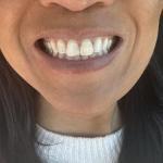Kansas City Smiles & Co Cosmetic Dentist in Independence