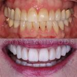 Kelly Dental Of Springfield Cosmetic Dentist in Springfield