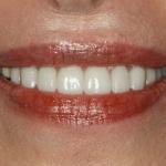 Koehn Dentistry & Aesthetics Cosmetic Dentist in Kansas City