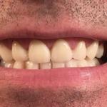 Landmark Dental Care Cosmetic Dentist in Nashua