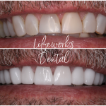 Lifeworks Dental Cosmetic Dentist in Houston
