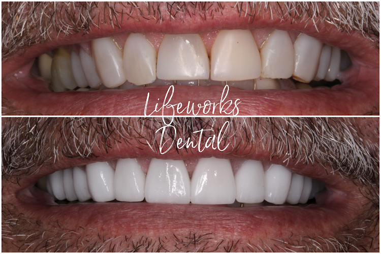 Negocio Lifeworks Dental