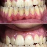 Make Me Smile Cosmetic Dentist in Yarmouth