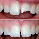 Maplewood Dental Arts Cosmetic Dentist in Gorham