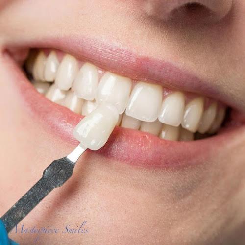 Negocio Masterpiece Smiles