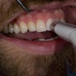 Meng Dentistry Cosmetic Dentist in Missoula