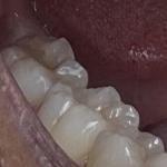 Michael D. Clark, Dds Cosmetic Dentist in White Hall