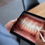 Missouri River Dental Cosmetic Dentist in Bismarck