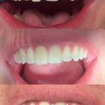 Mountain Ridge Dental Cosmetic Dentist in Bozeman
