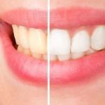 Natural Dental Partners Cosmetic Dentist in Phoenix