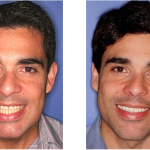 Neal C. Johnson Dmd - The Billings Dentist Cosmetic Dentist in Billings