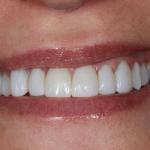 New England Dental Arts Cosmetic Dentist in Salem