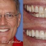 North Dallas Cosmetic Dentistry - Robert B. Mitchell Cosmetic Dentist in Dallas