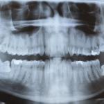 Northwest Family Dental Of Marysville Cosmetic Dentist in Marysville