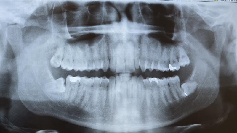 Negocio Northwest Family Dental Of Marysville