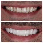 Park Ave Dental Aesthetics Weehawken Cosmetic Dentist in Weehawken