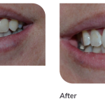 Peak Family Dentistry Cosmetic Dentist in San Gabriel Area