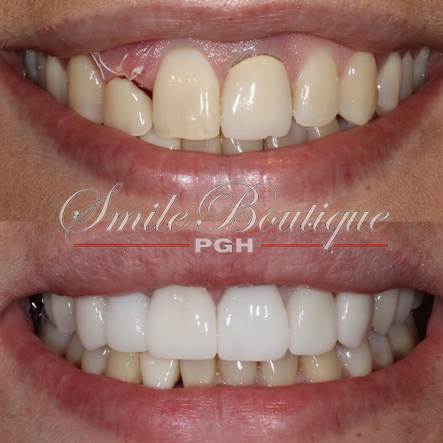 Negocio Pgh Smile Boutique