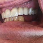 Robert F Wilcox Dmd Pc Cosmetic Dentist in Butte