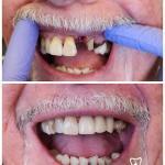 Rosemary Dental Spa Cosmetic Dentist in Cielito Lindo