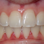 Salaita Orthodontics Cosmetic Dentist in Westerville