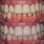 Sandlin Dental Cosmetic Dentist in Jonesboro