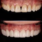 Sapphire Smiles - Dr. Antoun | Leading Cosmetic Dentist In Houston Cosmetic Dentist in Houston