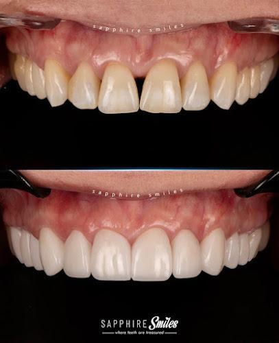 Negocio Sapphire Smiles - Dr. Antoun | Leading Cosmetic Dentist In Houston