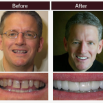 Scott Young, Dds Cosmetic Dentist in The Woodlands