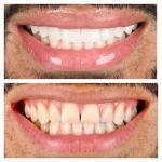 Seville Dental Aesthetics (West Office) Cosmetic Dentist in Kansas City