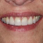 Shaun Janvier, D.m.d., Implant Cosmetic & Family Dentistry Cosmetic Dentist in Sanford