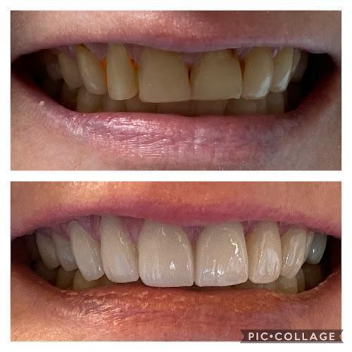 Negocio Sheibley Family Dentistry • General, Pediatric, And Cosmetic Dentistry. We Make Midlothian Texas Smile!