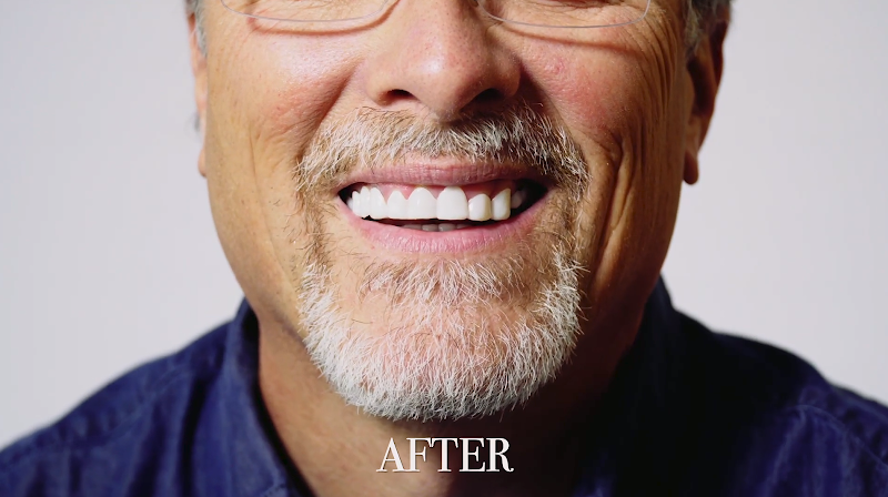 Negocio Shiny Smile Veneers