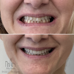 Skyline Dental Designs | General, Restorative, And Cosmetic Dentist In Weehawken Cosmetic Dentist in Weehawken