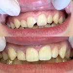 Smart Family Dentistry Cosmetic Dentist in Abilene