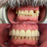 Smile Creators By Dr. Ripa Cosmetic Dentist in Bay Harbor Islands