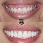 Smile Texas Cosmetic Dentist in Sugar Land