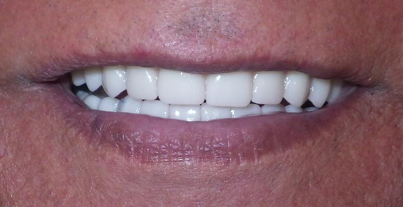 Negocio Spring Branch Dental Care Cosmetic And Implant Center