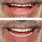 Stonelake Family Dentistry Cosmetic Dentist in Frisco