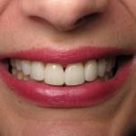 Studio Nine30 General And Cosmetic Dentistry | Dr. Matthew Engel Dmd Cosmetic Dentist in Bend