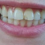 Summit Family Dental Care Cosmetic Dentist in Medford