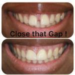 Terri Alani, Dds Cosmetic Dentist in Houston