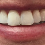 Teton Dental Arts Cosmetic Dentist in Jackson