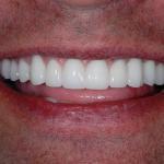 Texas Center For Cosmetic Dentistry, Dr. Guy Lewis And Dr. Teddy Cosmetic Dentist in The Woodlands